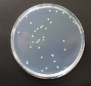 Bacteria Standard Plate Count Test Drinking Water Bacteria Standard Plate Count Test Drinking Water